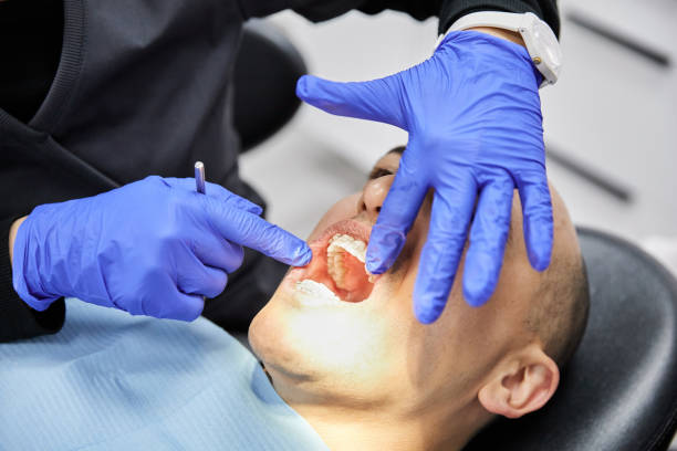 Best Emergency Tooth Extraction in Skiato, OK