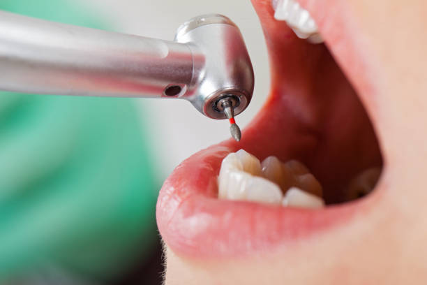 Best After-Hours Dental Trauma Care in Skiato, OK